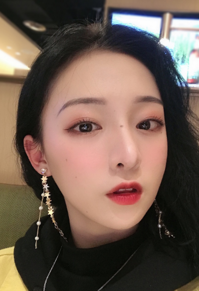 周娜醫(yī)生縮鼻頭案例效果圖 周娜醫(yī)生縮鼻頭案例效果圖