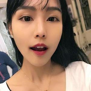 鞍山時(shí)代口腔門診部洗牙效果怎么樣？附申元休醫(yī)生洗牙案例效果圖