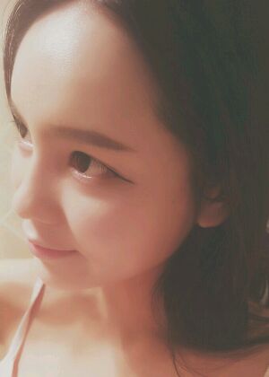 鞍山王景醫(yī)療美容外科診所做自體脂肪豐蘋果肌效果怎么樣？附張婉鸝案例效果圖