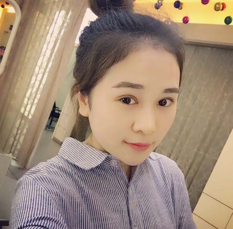 蚌埠韓美美萊整形醫(yī)生鄭捷做開(kāi)眼角怎么樣？附案例效果圖