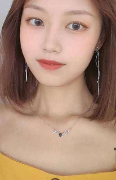 安陽市人民醫(yī)院燒傷整形中心做手術(shù)激光祛斑效果怎么樣？附案例效果對(duì)比圖