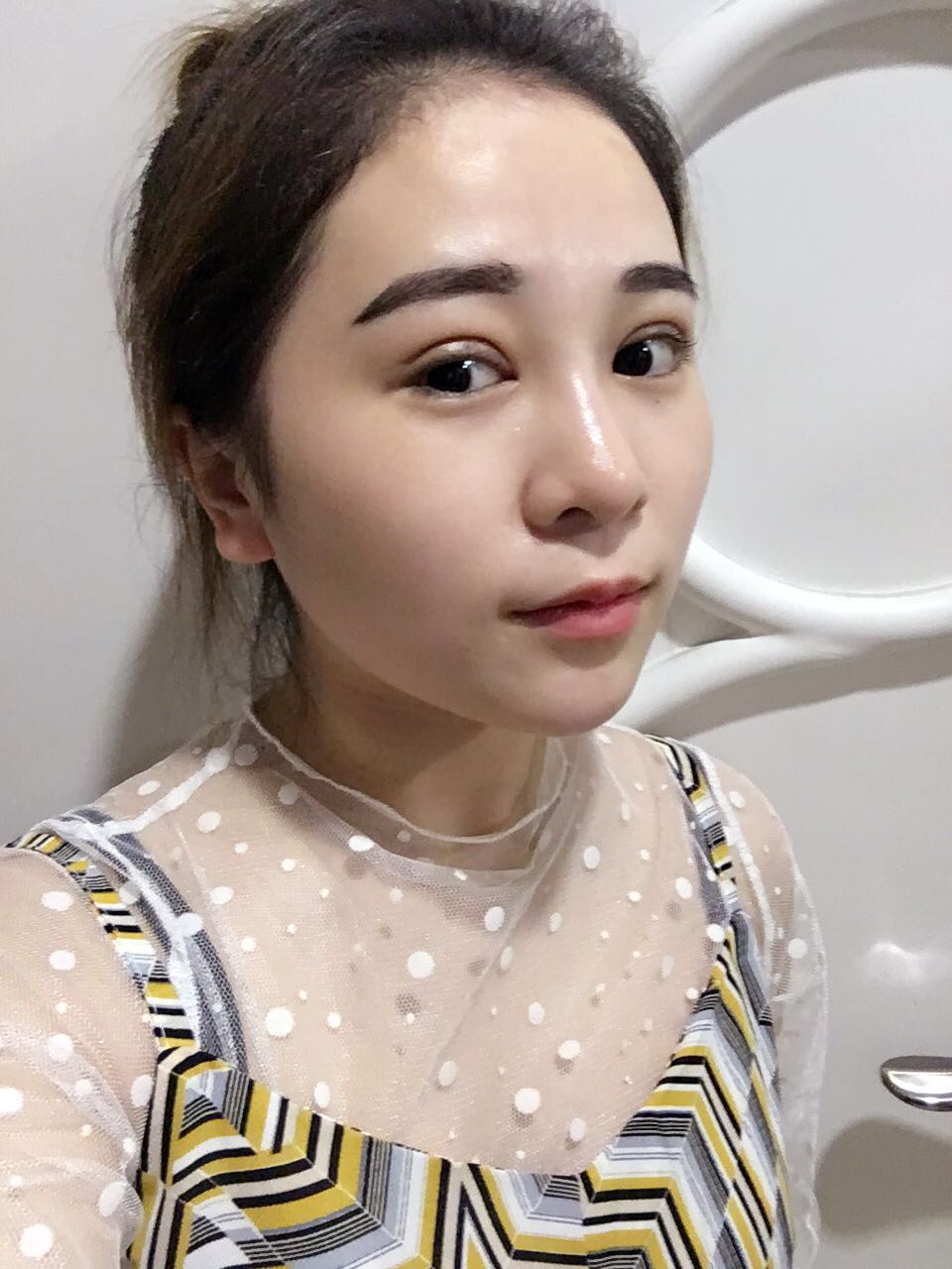 蚌埠韓美美萊整形醫(yī)生鄭捷做開(kāi)眼角怎么樣？附案例效果圖