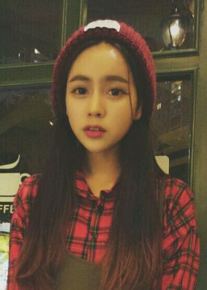 鞍山王景醫(yī)療美容外科診所做自體脂肪豐蘋果肌效果怎么樣？附張婉鸝案例效果圖