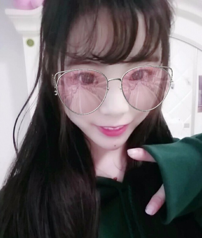 保定市第五醫(yī)院美容整形科做玻尿酸墊下巴怎么樣？附楊瑞萍醫(yī)生案例效果圖