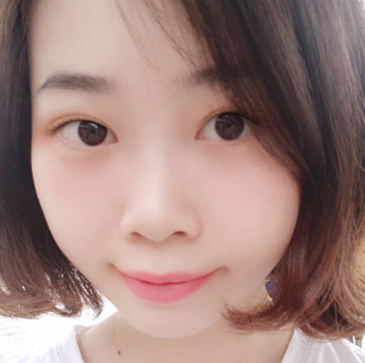 保定安卓貝拉醫(yī)療美容門診部孫大山醫(yī)生做雙眼皮+去眼袋怎么樣？附案例效果對比圖