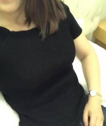 保定現(xiàn)代女子醫(yī)院整形美容中心做腰腹部吸脂怎么樣？附林秀蓮醫(yī)生案例效果圖