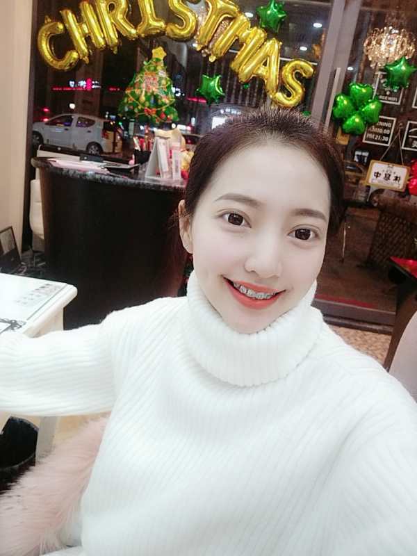 保定東陽口腔醫(yī)院溫興醫(yī)生做牙齒矯正怎么樣？附牙齒矯正案例效果對比圖