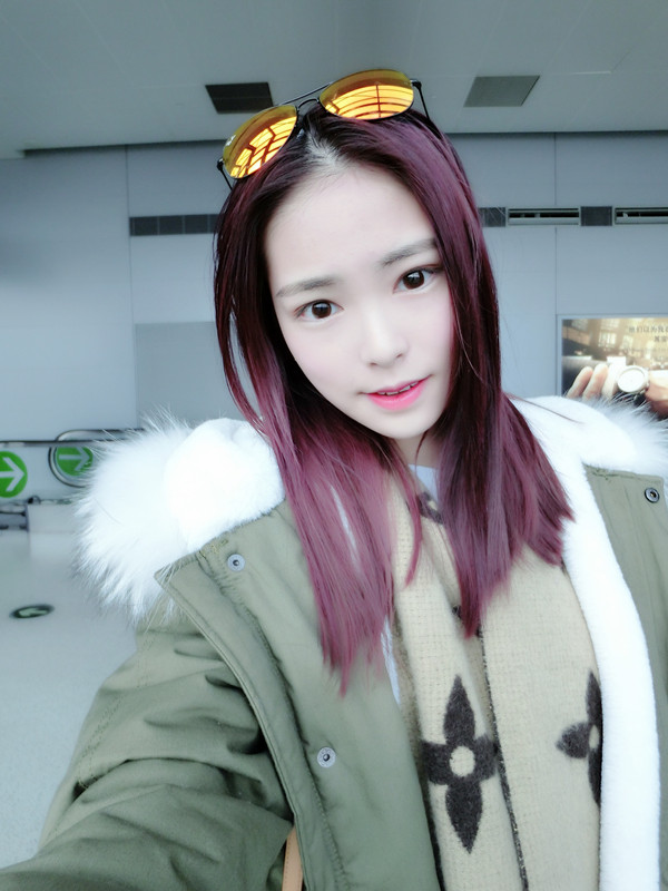 保定市第五醫(yī)院美容整形科做激光祛斑怎么樣？附單敬依醫(yī)生案例效果圖