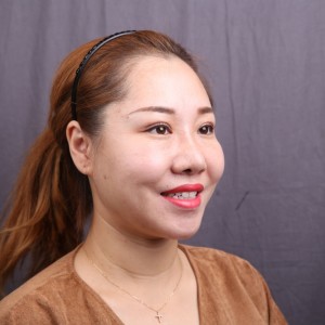 保定東陽口腔醫(yī)院趙晨醫(yī)生做瓷貼面怎么樣?附瓷貼面案例效果對比圖