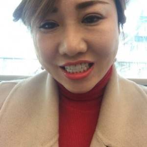 保定東陽口腔醫(yī)院趙晨醫(yī)生做瓷貼面怎么樣?附瓷貼面案例效果對比圖