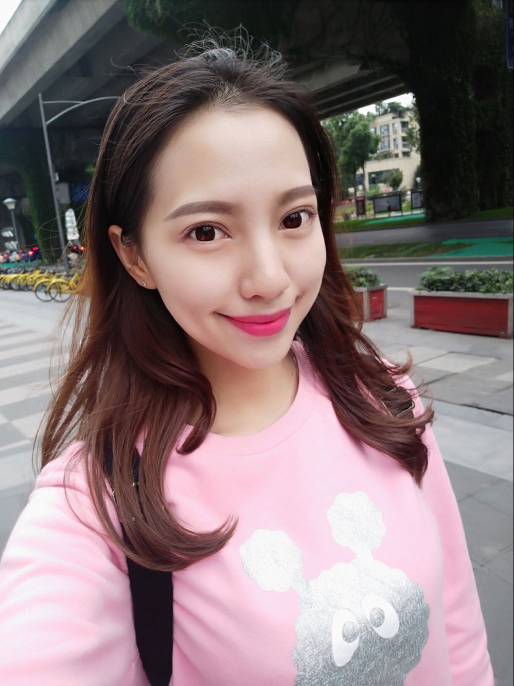 保定東陽口腔醫(yī)院溫興醫(yī)生做牙齒矯正怎么樣？附牙齒矯正案例效果對比圖