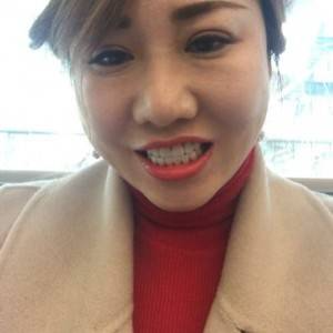 保定東陽口腔醫(yī)院趙晨醫(yī)生做瓷貼面怎么樣？附瓷貼面案例效果對(duì)比圖