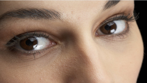 埋線雙眼皮需要多少錢？埋線雙眼皮需要取線嗎？