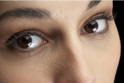 隆鼻假體能保持幾年？