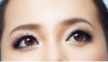 激光去黑眼圈多少錢？激光去黑眼圈效果好嗎？