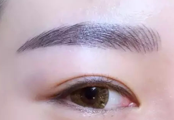 除皺去眼袋需要多少錢？價(jià)格貴嗎？