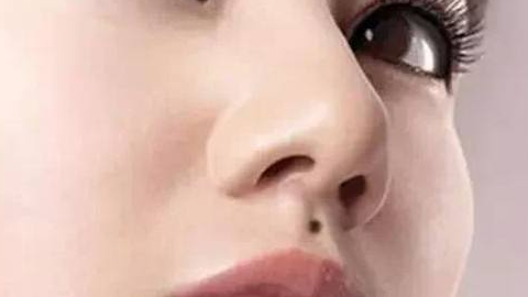 綜合隆鼻價格需要多少錢？價格貴嗎？