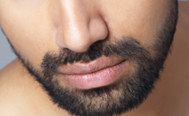 種植胡須大概多少錢(qián)？?jī)r(jià)錢(qián)貴嗎？