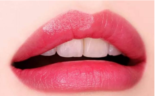 玻尿酸豐唇能保持多長時間？保持效果時間長嗎？