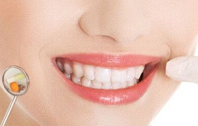 美容冠矯正是什么意思？