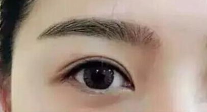 近視矯正手術(shù)的年齡范圍是多大？