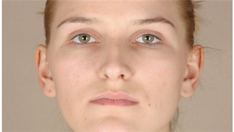 鐳射凈膚多少錢一次？