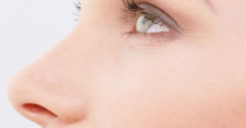 自體軟骨墊鼻尖好嗎？