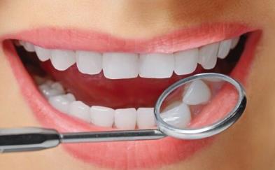 美容冠美白牙齒的費用是多少？