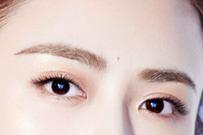 光纖去眼袋如何快速消腫？