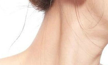 嗨體去頸紋能維持多久？一般打嗨體多少錢？