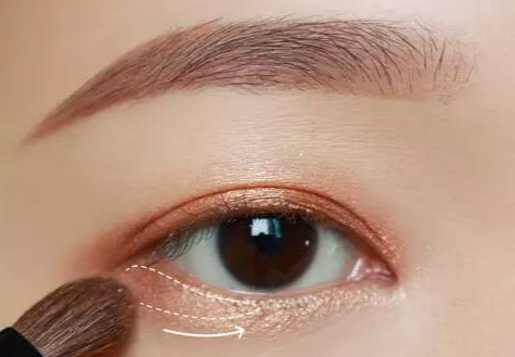 全切雙眼皮術(shù)后多久拆線？