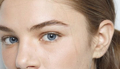 全切雙眼皮多久能恢復(fù)？