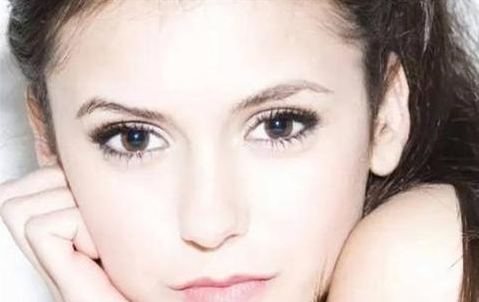 全切雙眼皮會留疤嗎？