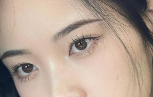 全切雙眼皮的特點(diǎn)有哪些？