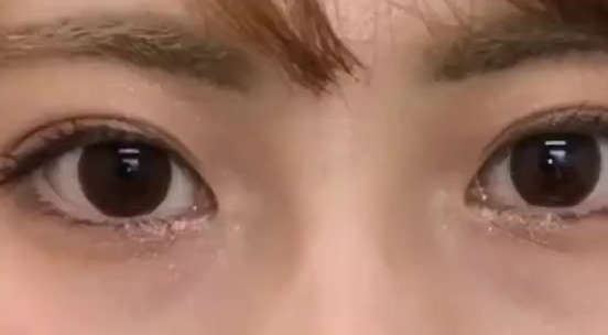 雙眼皮埋線后還可以開眼角嗎？做埋線雙眼皮有什么危險(xiǎn)？