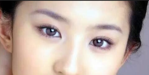 定點雙眼皮會有疤痕嗎？