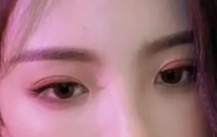 定點(diǎn)雙眼皮可以管多久？