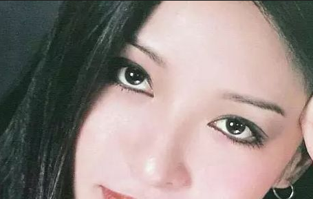 割雙眼皮會反彈嗎？