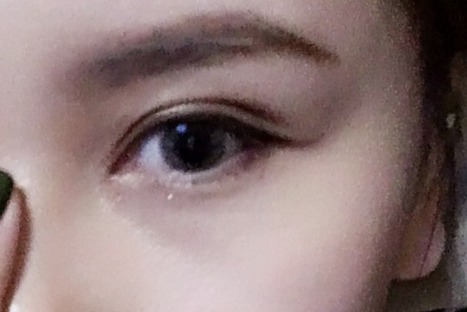 做雙眼皮多久冰敷一次？