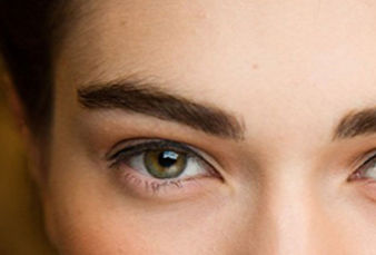 韓式開眼角的恢復期要多久？