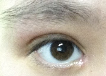 韓式開眼角的效果怎么樣？