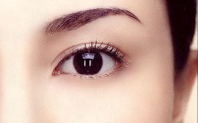 韓式開眼角多久恢復(fù)自然？韓式開眼角的特點有哪些？