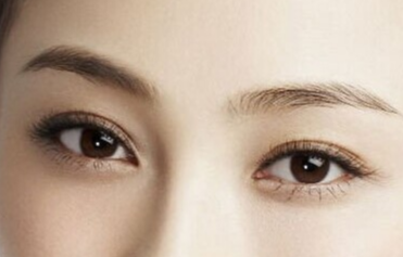 韓式開眼角手術(shù)的恢復(fù)時(shí)間？