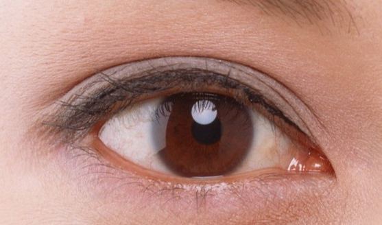 韓式開(kāi)眼角安全嗎？