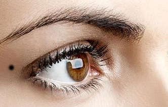 開內(nèi)外眼角疼嗎？開內(nèi)外眼角手術(shù)有什么風(fēng)險(xiǎn)？