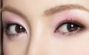 開(kāi)內(nèi)眼角疤痕怎么消除？開(kāi)內(nèi)眼角能保持多久？