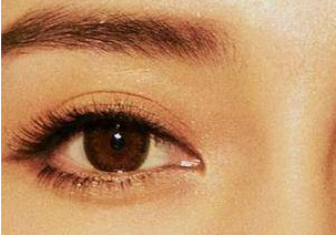 開眼角的恢復(fù)是多久？