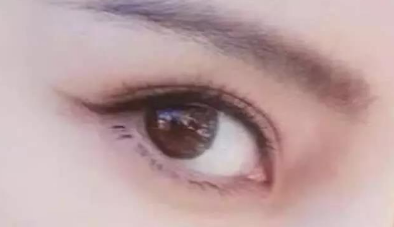 開眼角多久可以完全恢復(fù)？