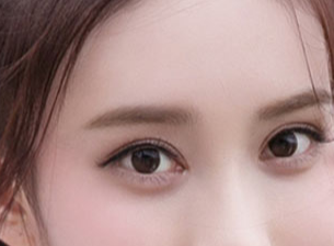 開眼角一般需要多少錢？