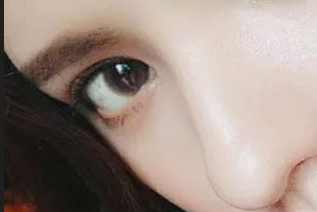 開眼角有害嗎？